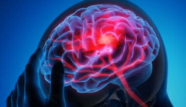 Man with a headache - Stroke -3D Illustration